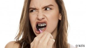 Thói quen vệ sinh răng miệng không tốt dẫn đến hàm răng kém trắng sáng